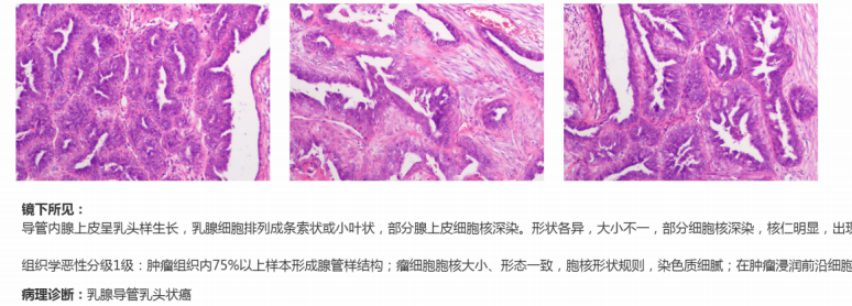 患有「乳腺肿瘤」的狗狗，该怎么防治不再遭受痛苦？